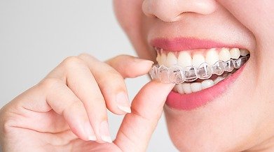 doctor-orthodontist-shows-how-sy